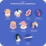 Recognizing Uncommon Symptoms of Endometriosis and What To Look For