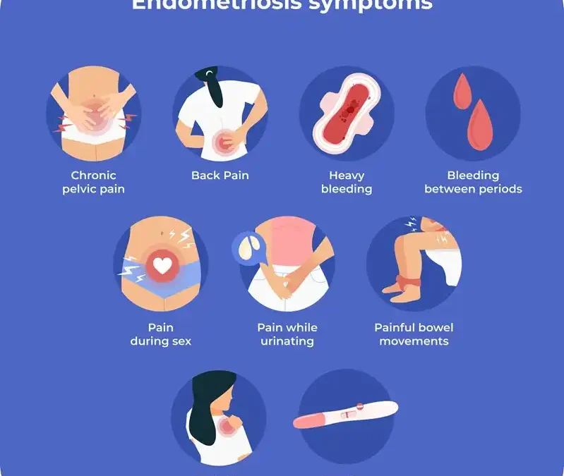 Recognizing Uncommon Symptoms of Endometriosis and What To Look For