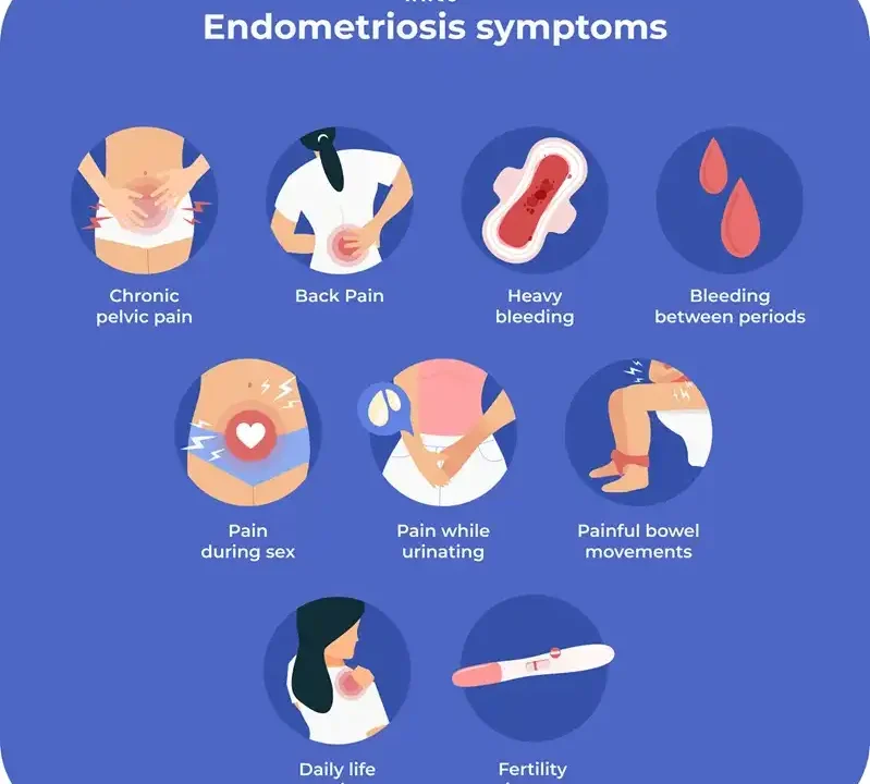 Recognizing Uncommon Symptoms of Endometriosis and What To Look For