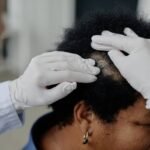 Benefits of Using Hair Loss Treatments