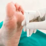 The Connection Between Ankle Wounds and Diabetes