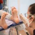 Exploring Treatments for Plantar Warts