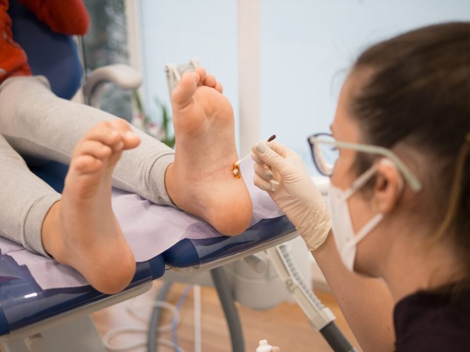 Exploring Treatments for Plantar Warts