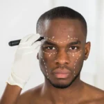 The Necessity of Researching Plastic Surgery Options